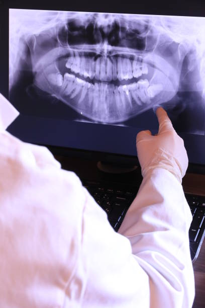 Best Emergency Root Canal Treatment in Holiday City Berkeley, NJ